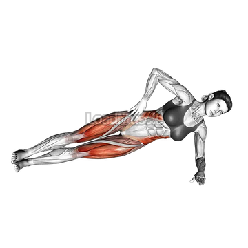 Side Bridge (knee tuck)